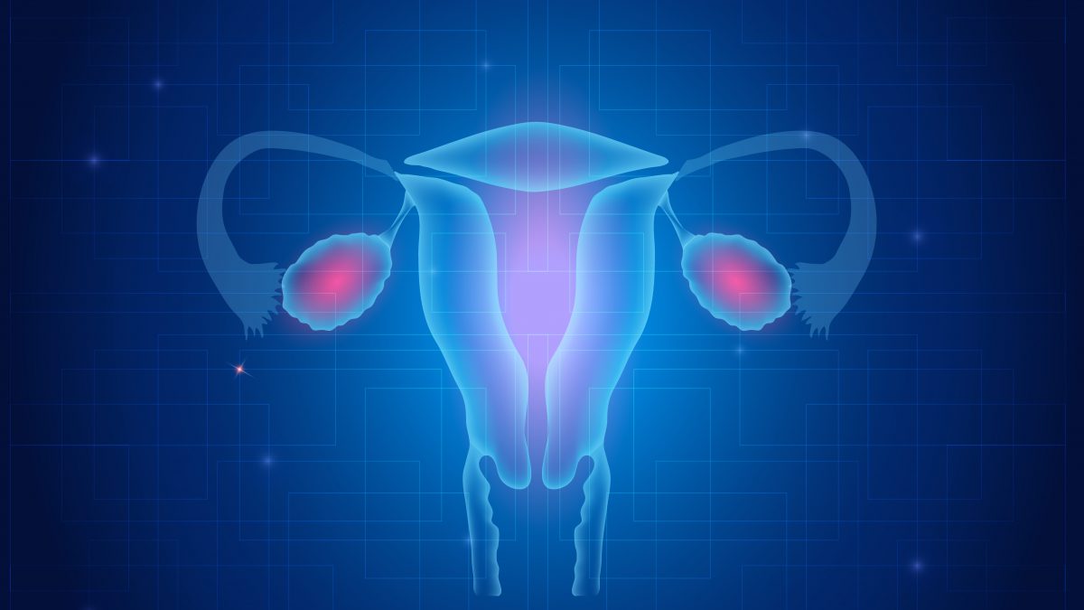 cervical cancer