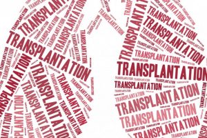 Lung transplant