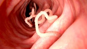 health parasites tapeworm 1200x675 1