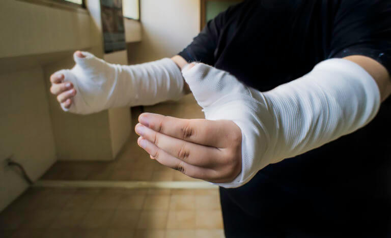 fracture