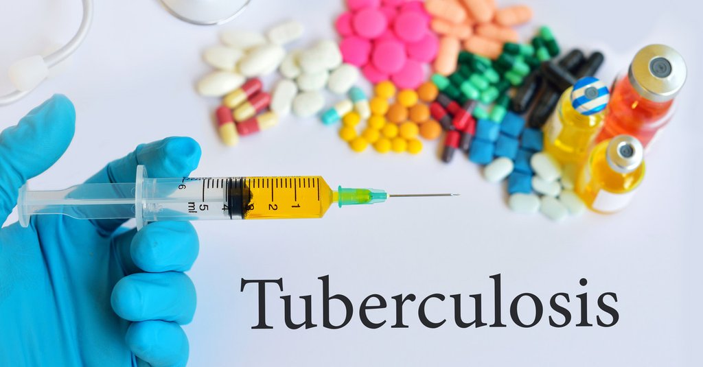 Prevention of tuberculosis
