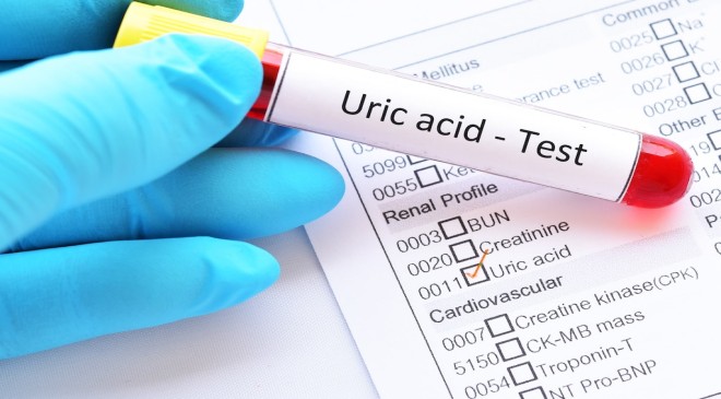 Mastering Uric Acid: Symptoms, Causes, and Lifestyle Strategies for Optimal Health