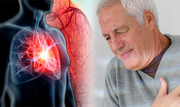 Expert Insights: Unveiling the Surge in Heart Diseases - Causes, Risks, and Lifestyle Solutions