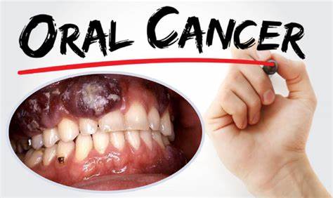 The Silent Threat: 5 Major Risk Factors for Oral Cancer