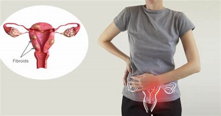 Silent Threat Unveiled: Recognizing Ovarian Cancer Symptoms That Demand Attention!