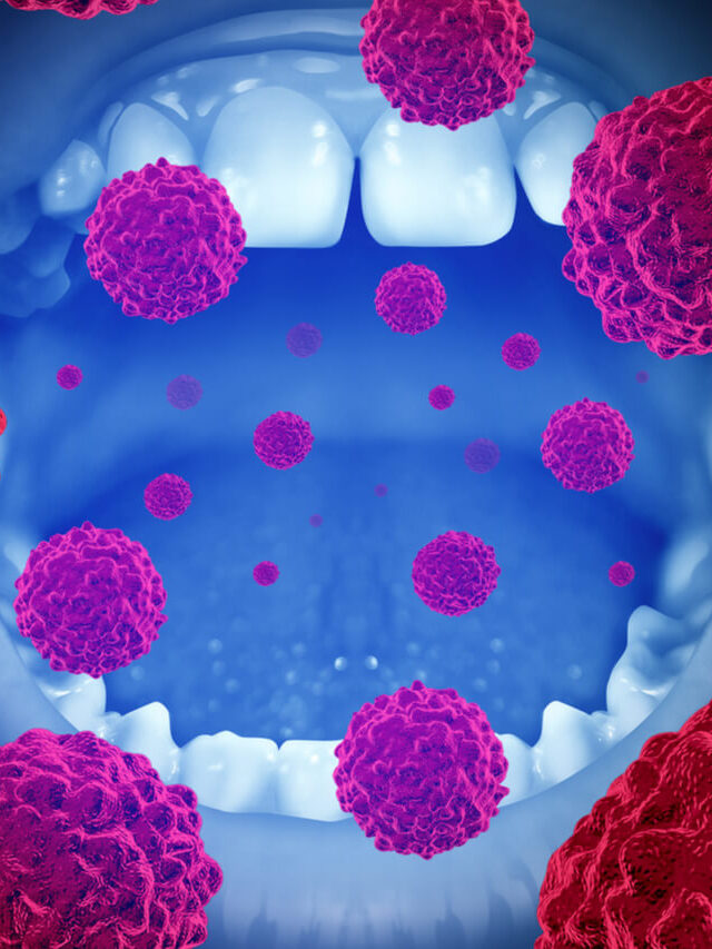 Silent Threat: 5 Ways to Fight Oral Cancer & the Warning Signs You Shouldn't Ignore!