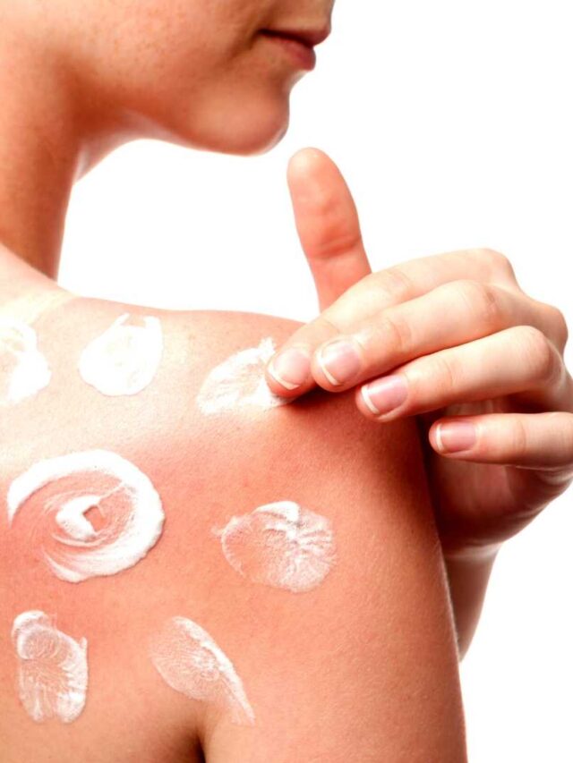 Silent Killer Under the Sun: Unveiling Skin Cancer's Hidden Signs.