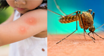 Dengue Fever’s Hidden Danger: Expert Explains Neurological Complications