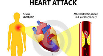 Watch Video: Uncover the Causes of Heart Attacks and How to Prevent Them