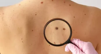 IMPORTANT PRE-CANCEROUS SYMPTOMS YOU SHOULDN’T IGNORE FOR EARLY DETECTION AND BETTER HEALTH
