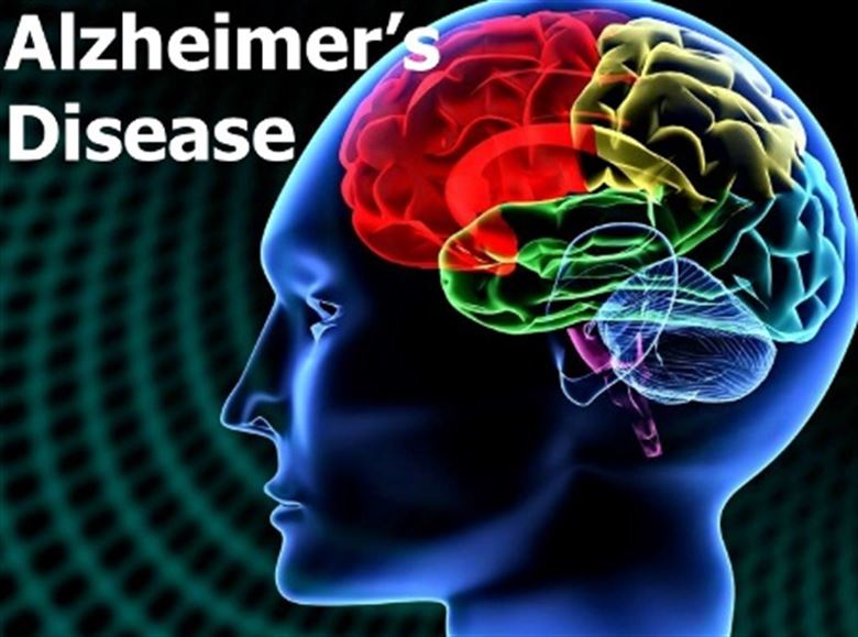 "Guard Your Mind: Lifestyle Choices to Reduce Alzheimer's Risk and Enhance Brain Health"