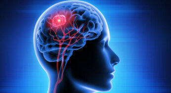 BREAKTHROUGH CANCER TREATMENT DRUG COULD REVOLUTIONIZE OUTCOMES FOR BRAIN CANCER PATIENTS
