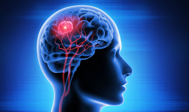 Breakthrough Cancer Treatment Drug Could Revolutionize Outcomes for Brain Cancer Patients