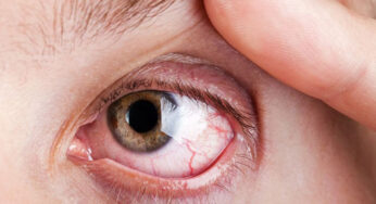 NEW DIABETIC RETINOPATHY SCREENING GUIDELINES LAUNCHED BY VRSI AND RSSDI: A STEP TOWARDS PRESERVING YOUR SIGHT