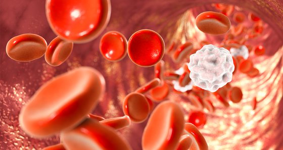 Watch This Video to Uncover the Alarming Health Risks Behind Night Sweats: Could It Be Lymphoma?