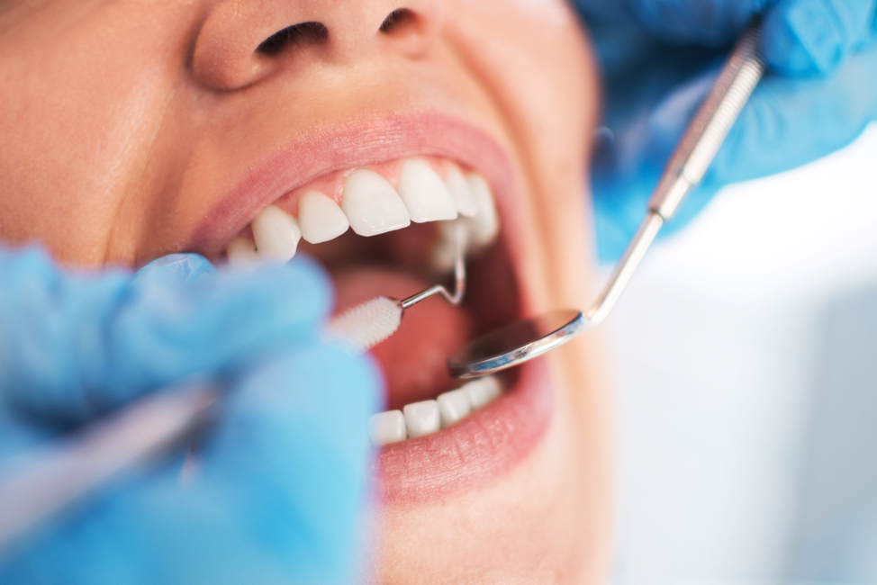 Teeth and Health: Here are 5 Health Issues Linked to Oral Health