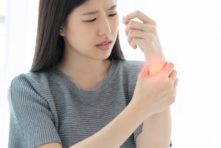 "Natural Ways to Reduce Heat Edema: Remedies and Prevention Tips for a Swelling-Free Summer"