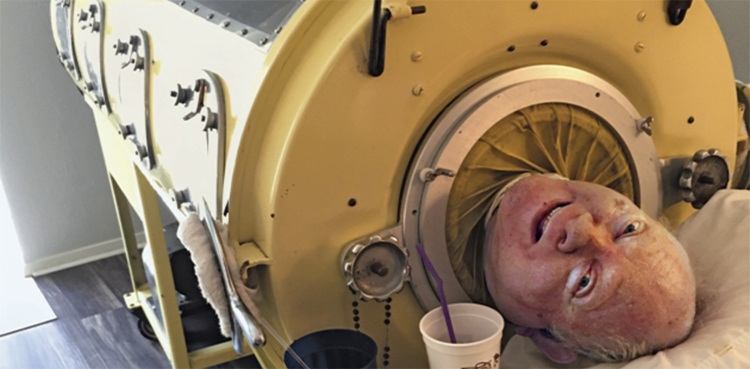 "The Iron Lung: A Lifeline in the Fight Against Polio and the Evolution of Respiratory Support"