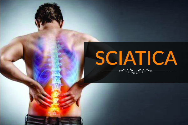 "Rising Cases of Sciatica in India: Understanding the Causes, Prevention, and Effective Treatment Options"