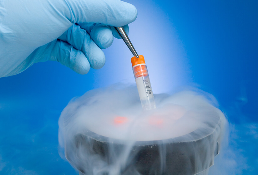 Egg Freezing: What Is It, Why and When Should You Consider It?