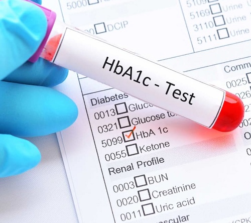"What You Didn’t Know About HbA1c: Are You Misinterpreting Your Blood Sugar Results?"