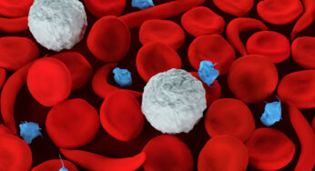 Sickle Cell Disease: A Growing Health and Social Challenge