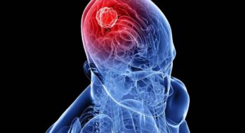 Morning Headaches: A Potential Warning Sign of Brain Tumors