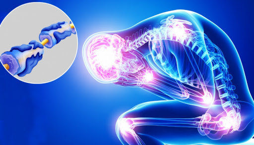 Guillain-Barré Syndrome in Pune: Signs, Treatment, and Hope for Recovery