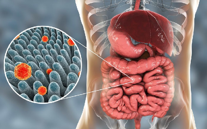 Intestinal Infections: Causes, Symptoms, and Prevention Tips