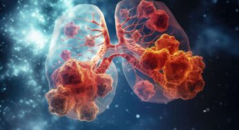 Mycoplasma Pneumonia: Unmasking the Silent Respiratory Threat