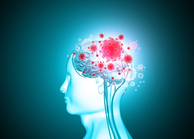 Long COVID and Brain Swelling: The Hidden Threat to Your Cognitive Health