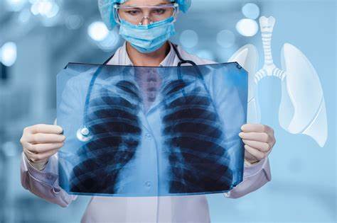 Study Uncovers Hidden Lung Damage in Kids and Teens with Long Covid