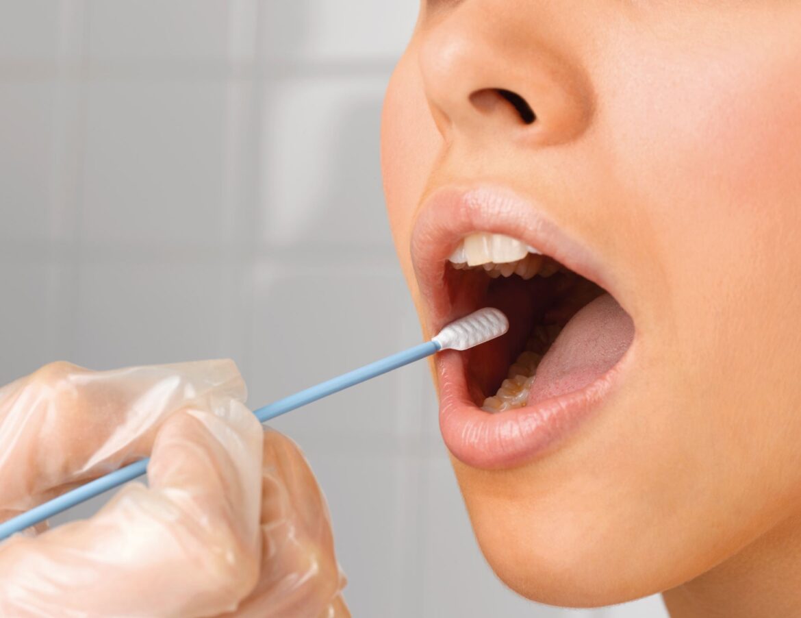 FORGET NEEDLES; THIS SIMPLE AT-HOME SPIT TEST MAY REVOLUTIONIZE PROSTATE CANCER DETECTION