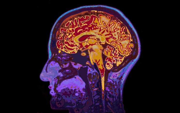 Your Dad’s Alzheimer’s Diagnosis Could Increase Your Risk, Says New Study
